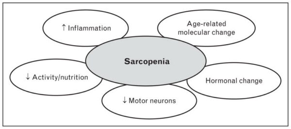 Sarcopenia Factors