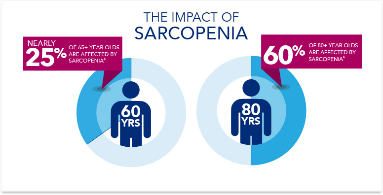 Sarcopenia Effects In Older Adults