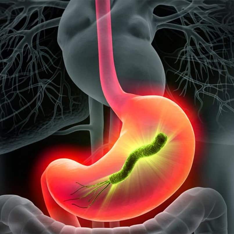 The Best Natural Treatments for H Pylori Bacteria